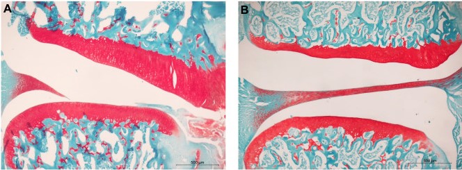 Histopathology of knee joint sections.jpg